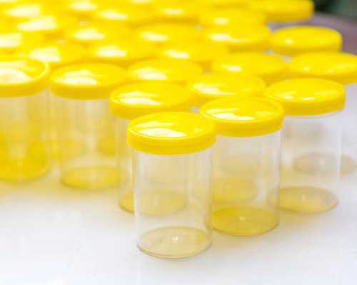 国内试管代生代怀,怀孕拉腹部的原因？