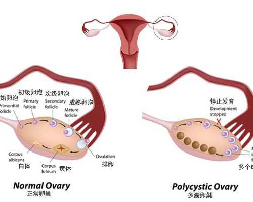 国内代生机构代妈,试管婴儿多久胚胎移植成功率高？试管婴儿多少天移植？